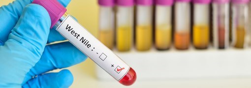 בדיקת מחלת נגיף הנילוס המערבי West-Nile Virus Test) WNV) - תמונה